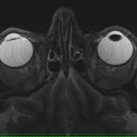 Resonancia nuclear magnetica de orbitas 883103. Idime. (2022)