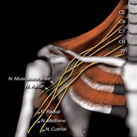 Resonancia nuclear magnetica de plejo braquial. 883560 Idime. (2022)