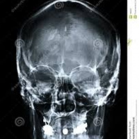 Radiografia de cara, perfilograma.870101 Idime