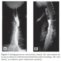 Radiografia de vias digestivas altas (esofago, estomago, duodeno) con doble contraste. 872122 Idime