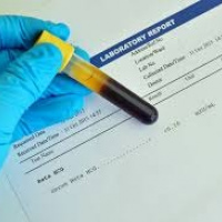 Gonadotropina corionica subunidad Beta cualitativa, prueba de embarazo. 904508 Idime (2022)