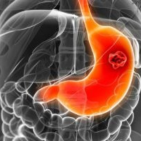 Escleroterapia. Uniendoscopia (2023)