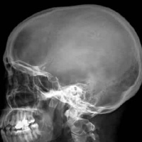 Radiografia de craneo simple. 870001 Idime