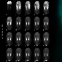 Venogamagrafia.920412  Idime (2024)