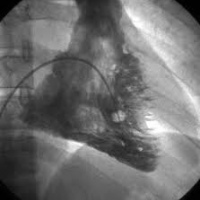 Ventriculografia en reposo. 920404  Idime (2024)