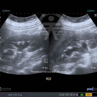 Ecografia de vias urinarias (riñones, vejiga prostata) transabdominal. 881332 Idime