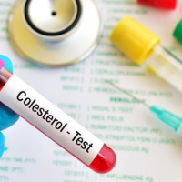 Colesterol total. 903818  Idime. (2022)