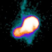 Gamagrafia de reflujo gastroesofagico.920606 Idime (2024)