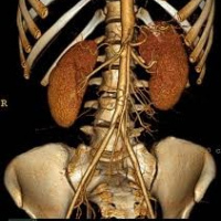 Tomografia computada en reconstruccion tridimensional. 879910 Idime