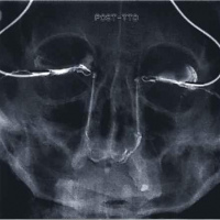 Dacriocistografia bilateral. 874602 Idime