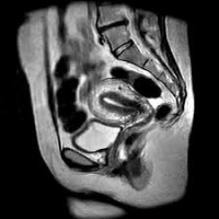 Resonancia nuclear magnetica de pelvis 883440. Idime (2022)
