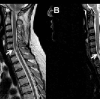 Resonancia nuclear magnetica de columna cervical simple.883210. Idime (2022)