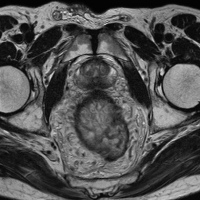 Resonancia nuclear magnetica de pelvis simple y contrastado. EN, codigo 883440 SC (2022)