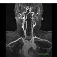 Resonancia nuclear magnetica con angiografia de cuello. 883909  Idime