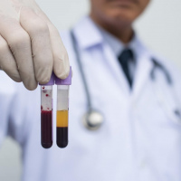 Inmunoglobulina E. 906836 Idime (2022)