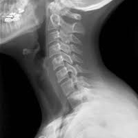 Radiografia de columna cervical. 871010  Idime