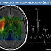 Espectroscopia. Idime