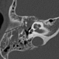 Radiografia de peñascos.870006 Idime