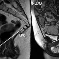 Resonancia nuclear magnetica dinamica de piso pelvico. EN. Codigo 883441 (2022)