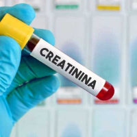 Creatinina depuracion.903823. Idime. (2022)