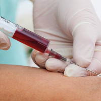 Prueba O'Sullivan confirmatoria tres muestras. 903845 Idime (2022)