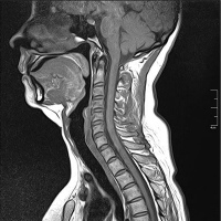 Resonancia nuclear magnetica de columna cervical con contraste. 883210. Idime