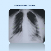 Apicograma.871202 Idime