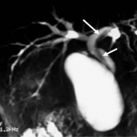 Colangiorresonancia.EN. Codigo 883434 (2022)