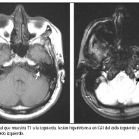 Resonancia nuclear magnetica de oidos con contraste. 883109. Idime