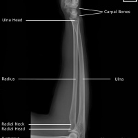 Radiografia de antebrazo.873122 Idime