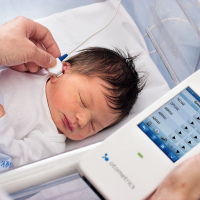 Emisiones otoacusticas. 954601. Audiosalud (2022)