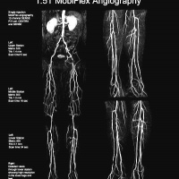 Angiotomografia de miembros inferiores.99999039 . Idime. (2024)