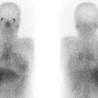 Gamagrafia con Galio 67. 921200  Idime (2024)