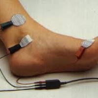 Electromiografia de tres a cuatro extremidades. 891508 / 930860. Idime