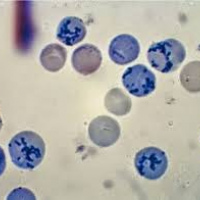 Recuento de reticulocitos. 902223  Idime (2022)