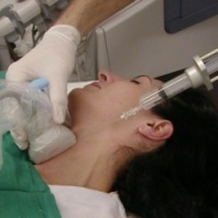 Biopsia por puncion con aguja fina de tiroides. 61002 Idime (2024)