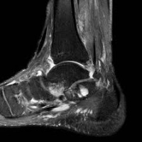 Resonancia nuclear magnetica de articulaciones de miembro inferior (especifico). 883522 Idime. (2022)
