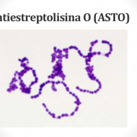 Antiestreptolisina semicuantitativa  906002   Idime. (2022)