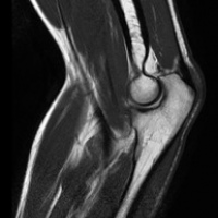 Resonancia nuclear magnetica de miembro inferior sin incluir articulaciones.883521 Idime (2022)