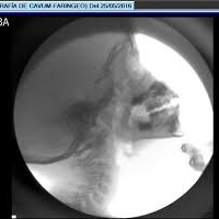 Radiografia de cavum faringeo.870602 Idime