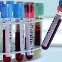 Albumina en suero u otros fluidos. 903803  Idime. (2022)