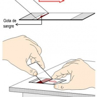 Extendido (frotis) de sangre periferica, estudio morfologico. 902206 Idime. (2022)