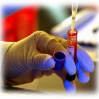 Acido urico en suero. 903801 Idime. (2022)